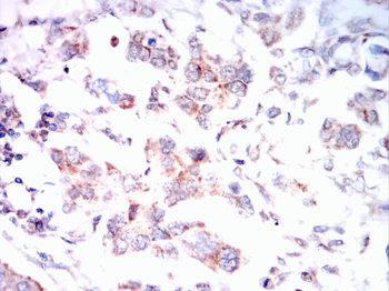 PSD95 Rabbit Polyclonal Antibody