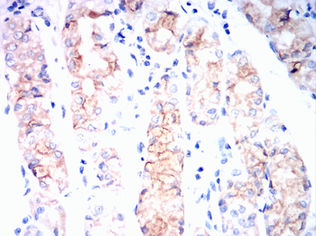 PSD95 Rabbit Polyclonal Antibody