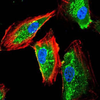 ABCG1 Rabbit Polyclonal Antibody
