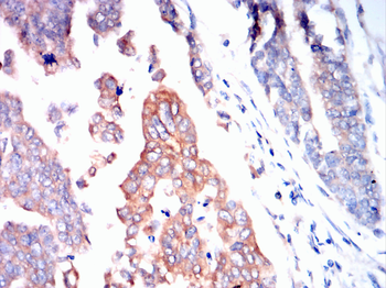 PMP22 Antibody