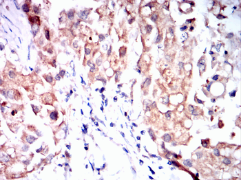 CPT2 Antibody