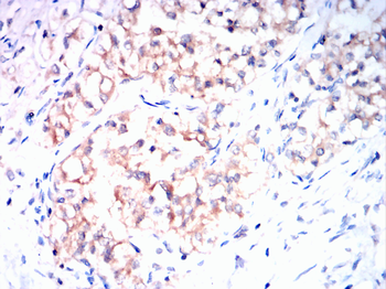 CPT2 Antibody