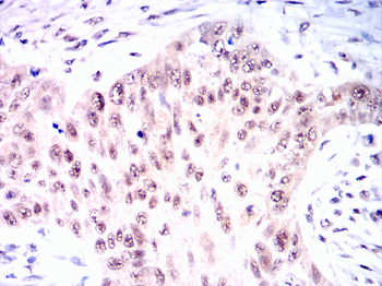 CDK5 Antibody