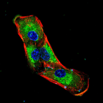 CDKN1B Antibody