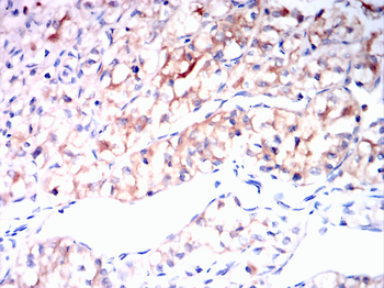 TP53BP1 Antibody
