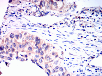 ATG5 Antibody