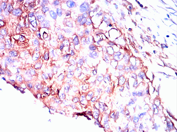 ATM Antibody