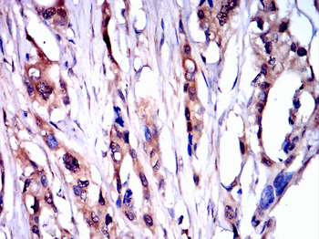 ATM Antibody