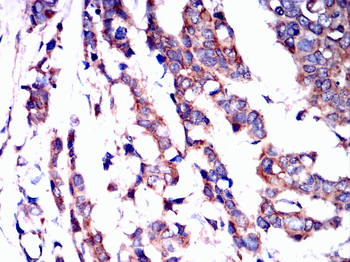 HK1 Antibody