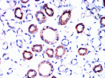 HK1 Antibody