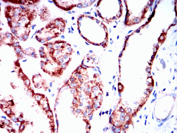 HK1 Antibody