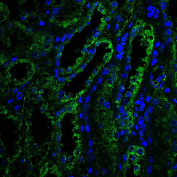 HK1 Antibody