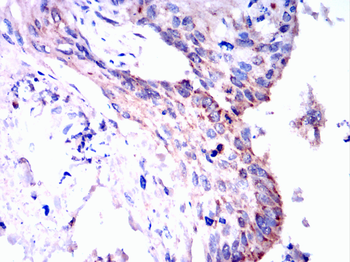 HK1 Antibody