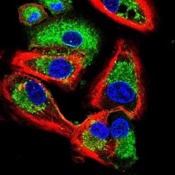 MCSF Rabbit Polyclonal Antibody