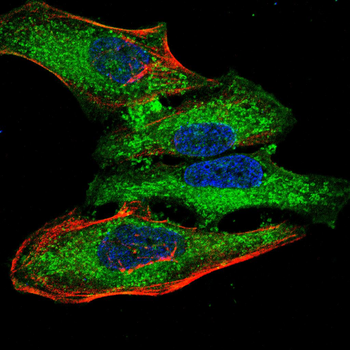 TIA1 Rabbit Polyclonal Antibody