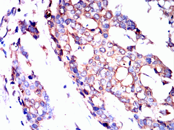 TIA1 Rabbit Polyclonal Antibody
