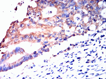 TIA1 Rabbit Polyclonal Antibody