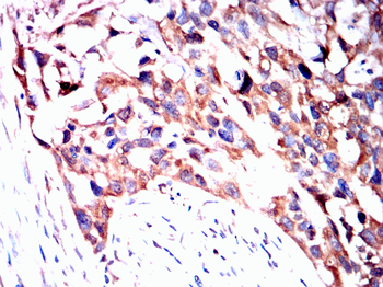 TIA1 Rabbit Polyclonal Antibody