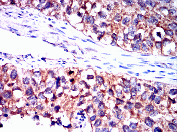 TIA1 Rabbit Polyclonal Antibody