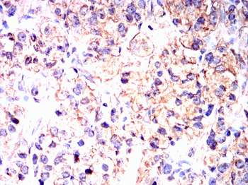 TIA1 Rabbit Polyclonal Antibody
