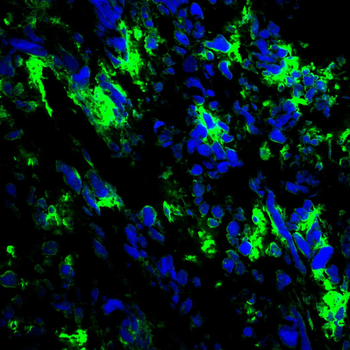 TIA1 Rabbit Polyclonal Antibody