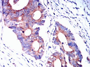 ROCK1 Antibody