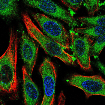 PDIA2 Antibody