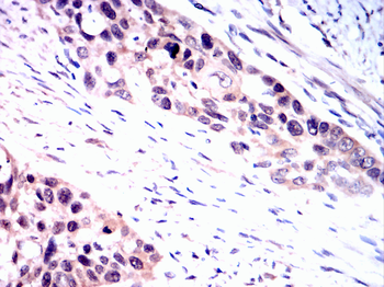 CHUK Antibody