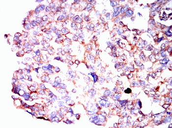 GLI1 Antibody
