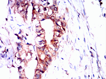 GLI1 Antibody