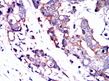 CGB3 Antibody