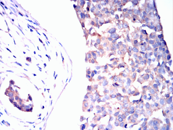 CGB3 Antibody