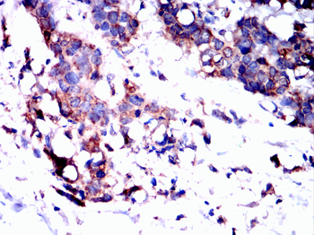 ITGB3 Antibody