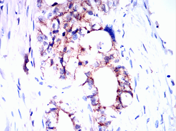 ITGB3 Antibody