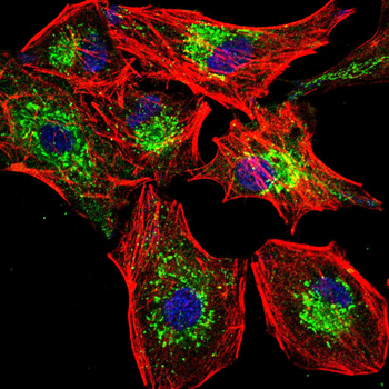 PIM1 Rabbit Polyclonal Antibody