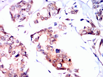 PIM1 Rabbit Polyclonal Antibody