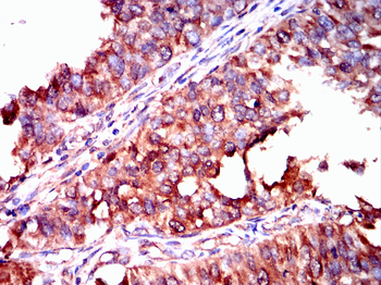 PIM1 Rabbit Polyclonal Antibody
