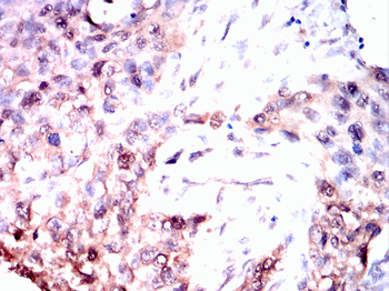 PIM1 Rabbit Polyclonal Antibody
