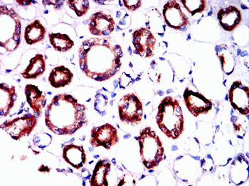 PIM1 Rabbit Polyclonal Antibody