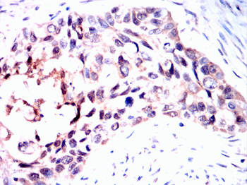 PIM1 Rabbit Polyclonal Antibody