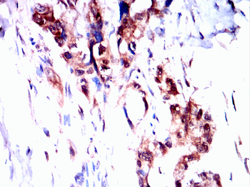 PIM1 Rabbit Polyclonal Antibody