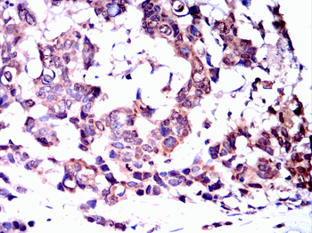 CNP Antibody