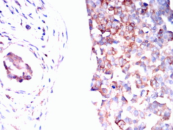 IFITM3 Antibody
