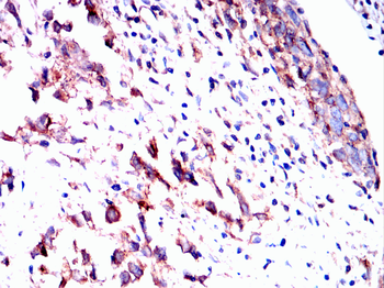 IFITM3 Antibody