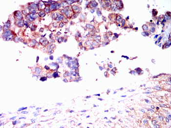 CNN1 Antibody