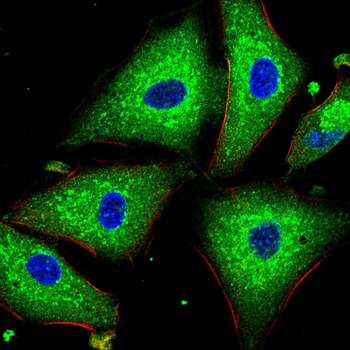 TTR Antibody