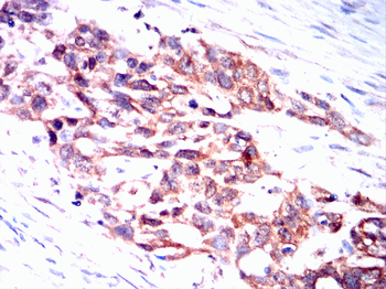 TTR Antibody