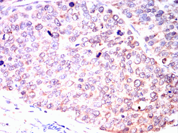 ACLY Antibody