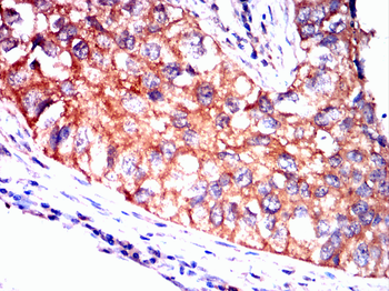 HSPH1 Antibody
