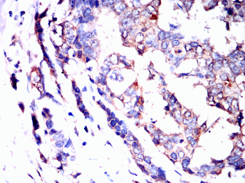 FTL Antibody